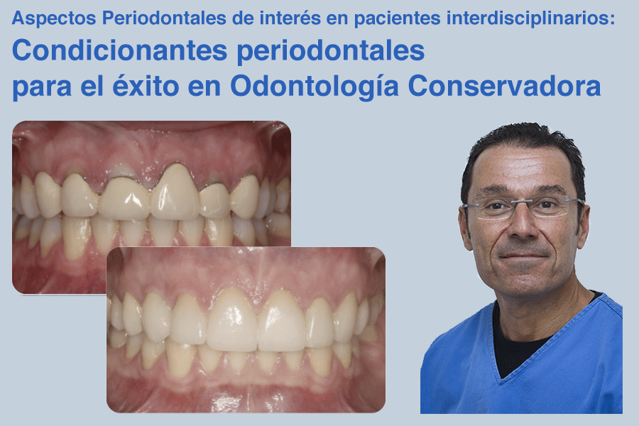 El Dr. Enrile habla de implantoprótesis en un curso de la Universidad de Sevilla