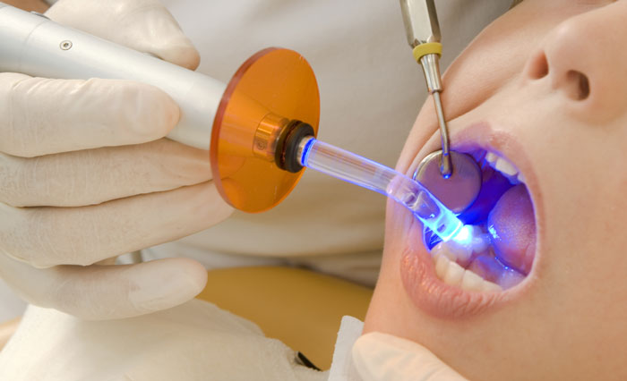Odontologia conservadora - odontología conservadora Odontologia conservadora