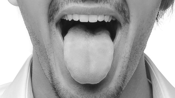Xerostomía o boca seca
