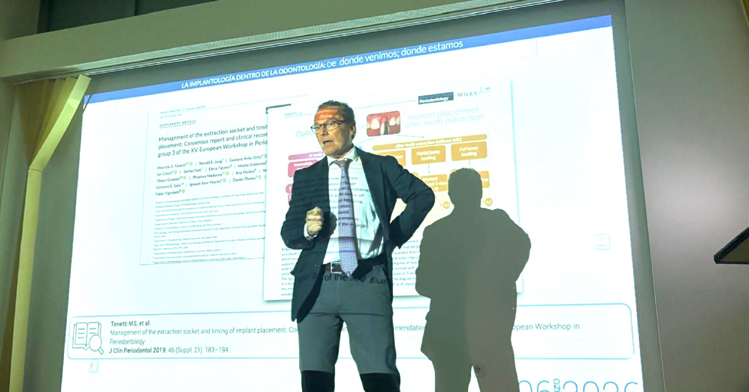 implantes dentales en Huelva